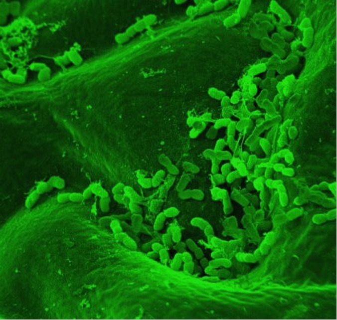 A scanning electron micrograph showing the initial stages of biofilm formation 